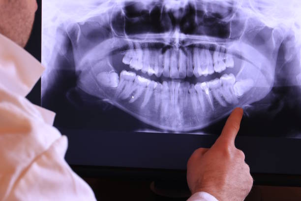 Best Pediatric Emergency Dentist in Le Center, MN