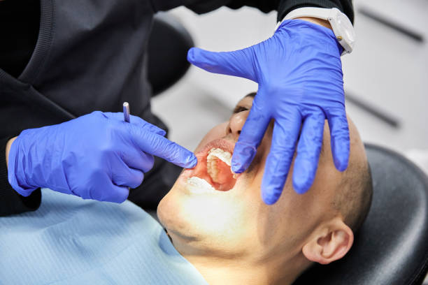 Best Emergency Treatment for Dental Infections or Abscesses in Le Center, MN